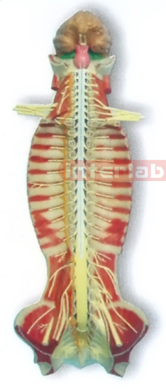 MAGNET-HANGING HUMAN SPINAL CORD MODEL IN SPINAL CANAL